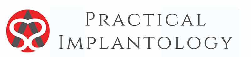 Implant Planning Mentoring