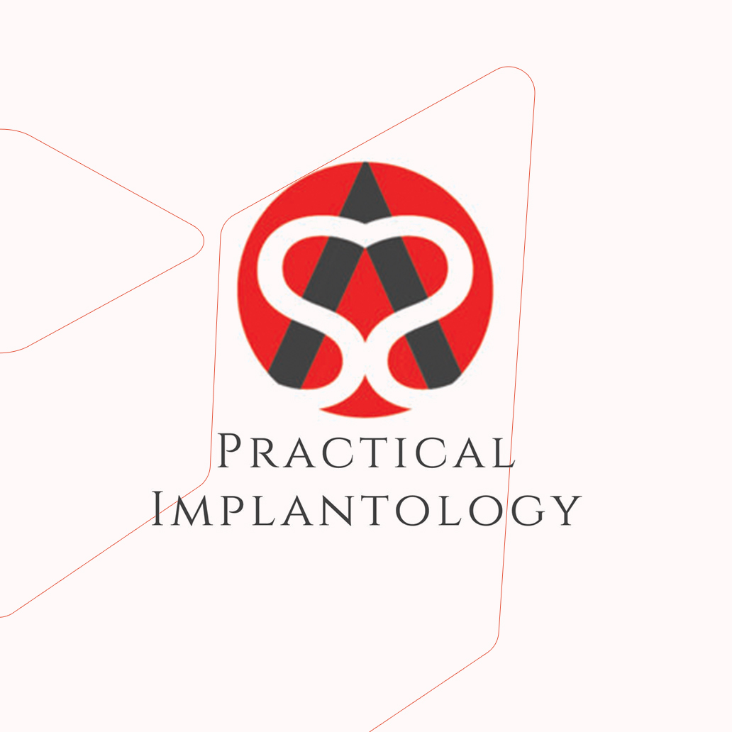 Implant Planning Mentoring